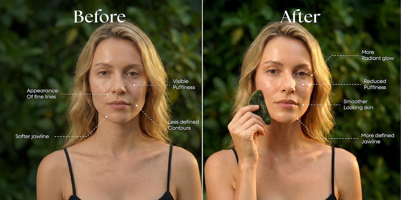 Before and After